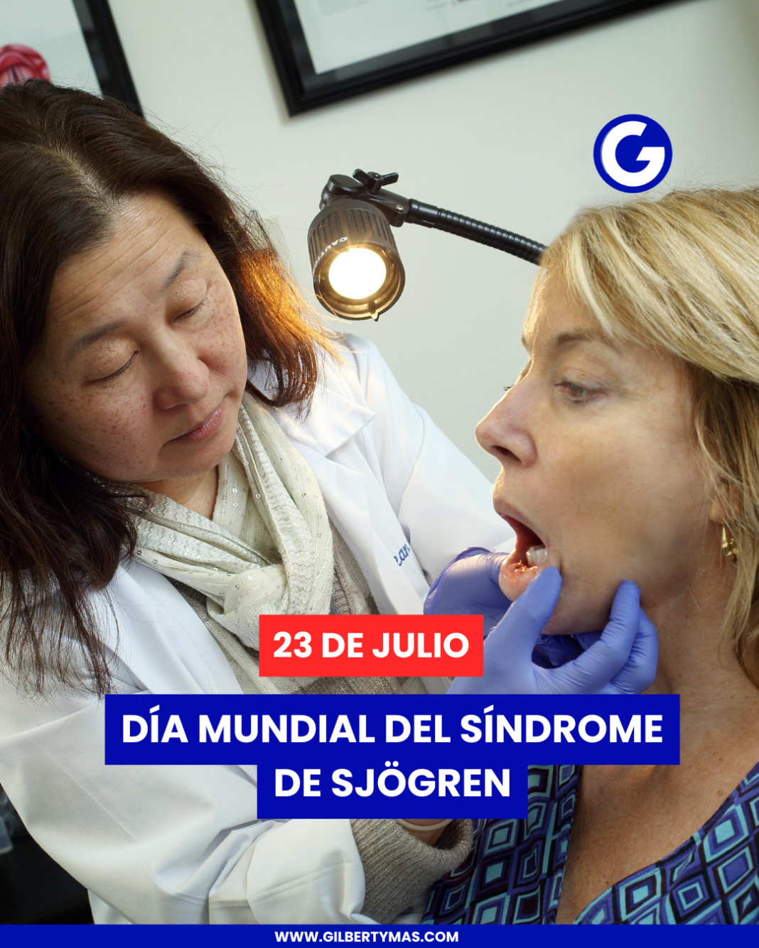 23 de julio | Día Mundial del Síndrome de Sjögren